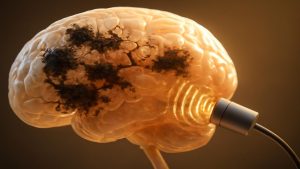 Scientists Use Simple Sound Waves to Break Down Alzheimer’s Brain Plaques